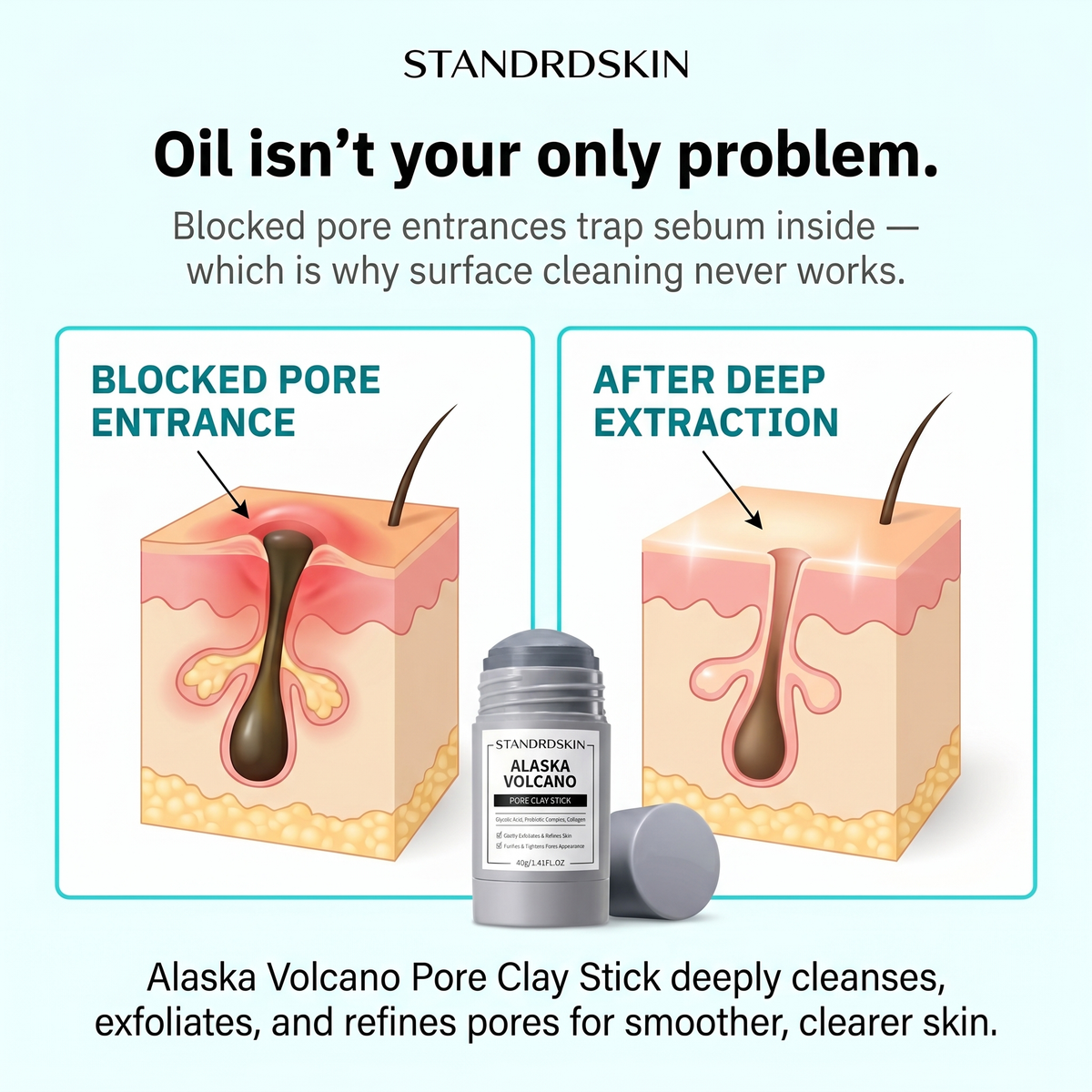 STANDRDSKIN PORE MUD MASK