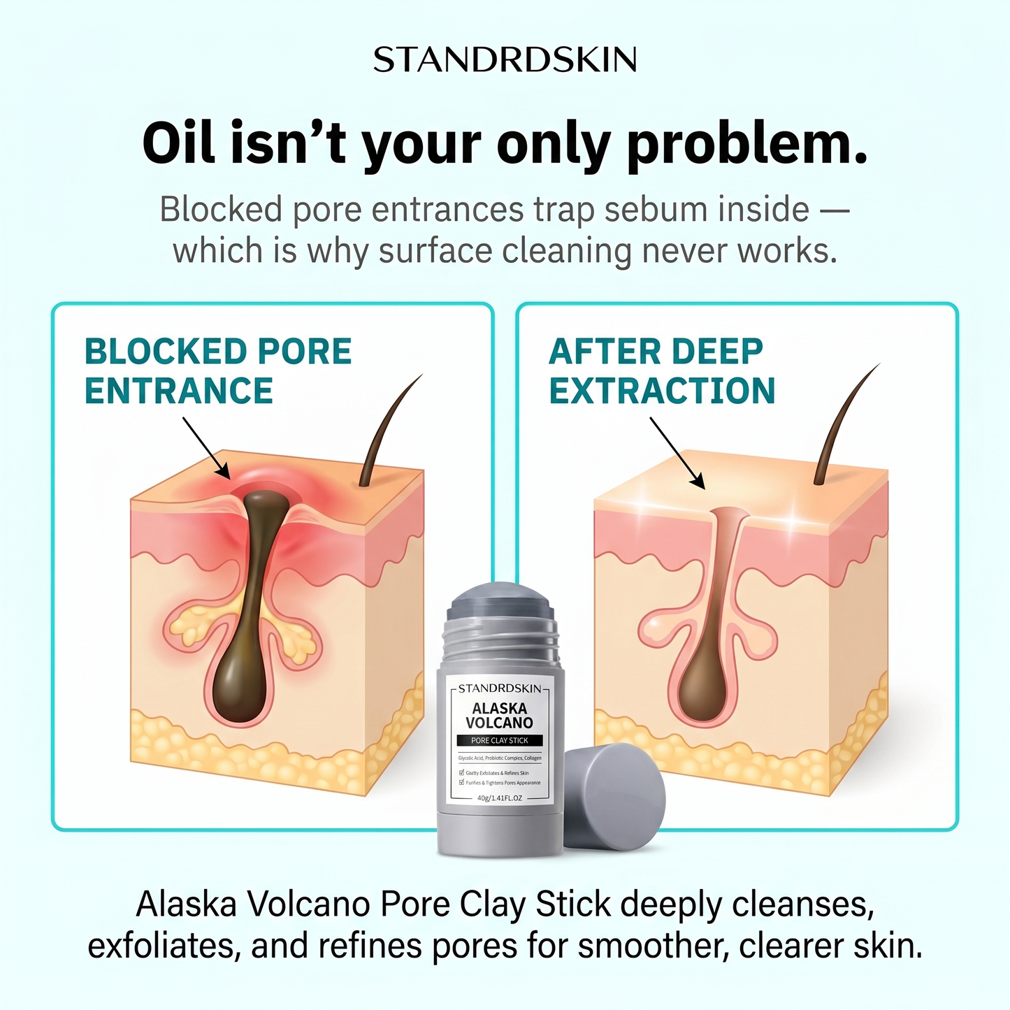 STANDRDSKIN PORE MUD MASK