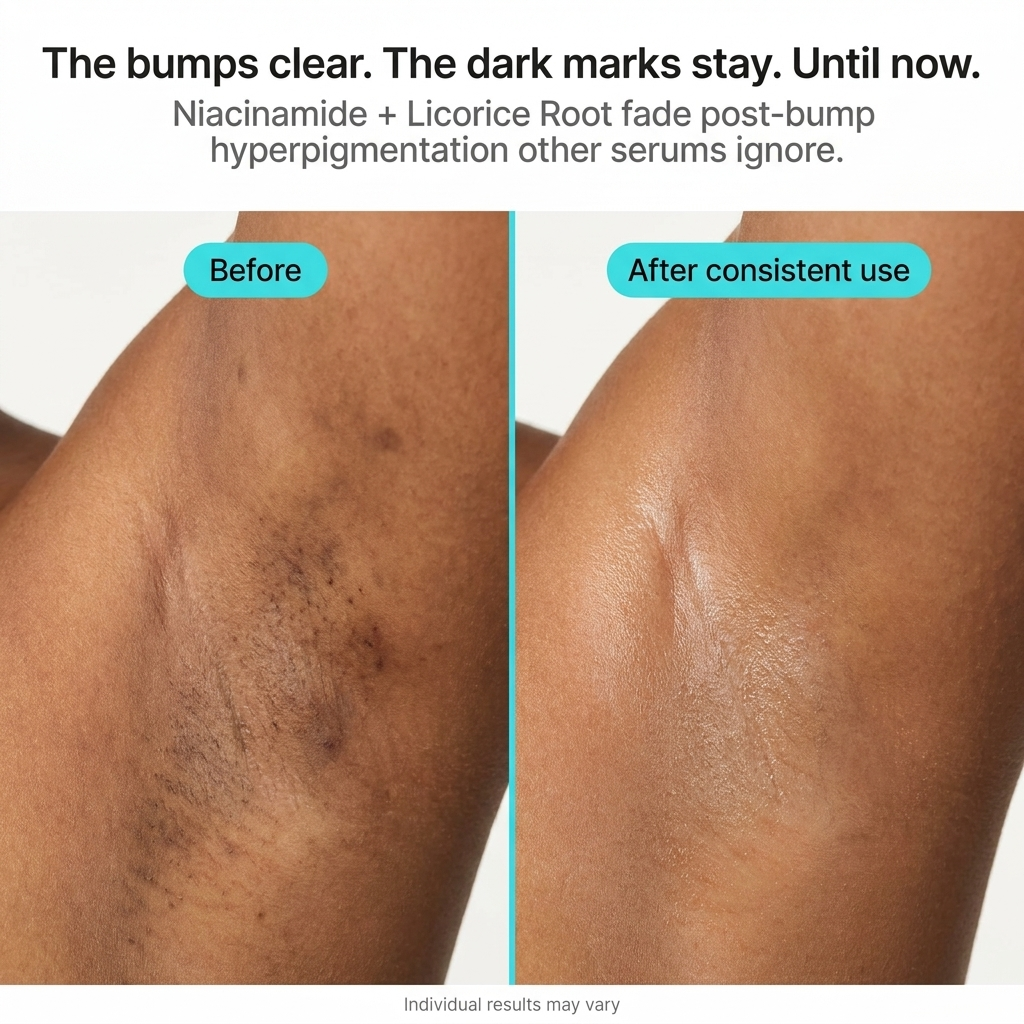 Ingrown Hair Serum (Post Shave)