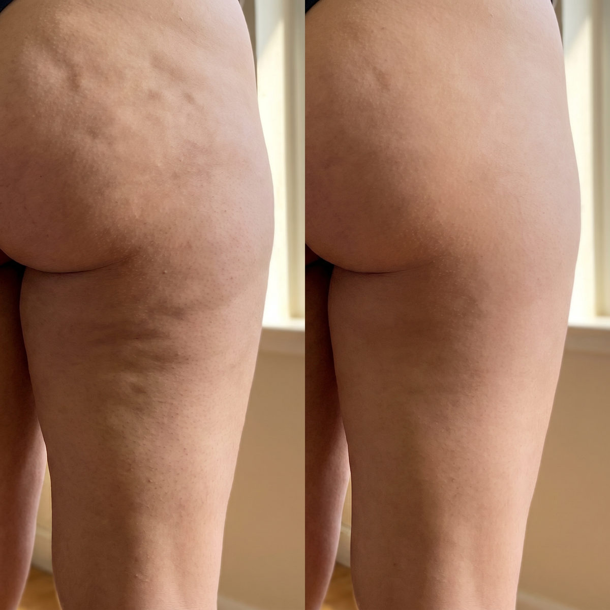 The Standard Sculpt Pro